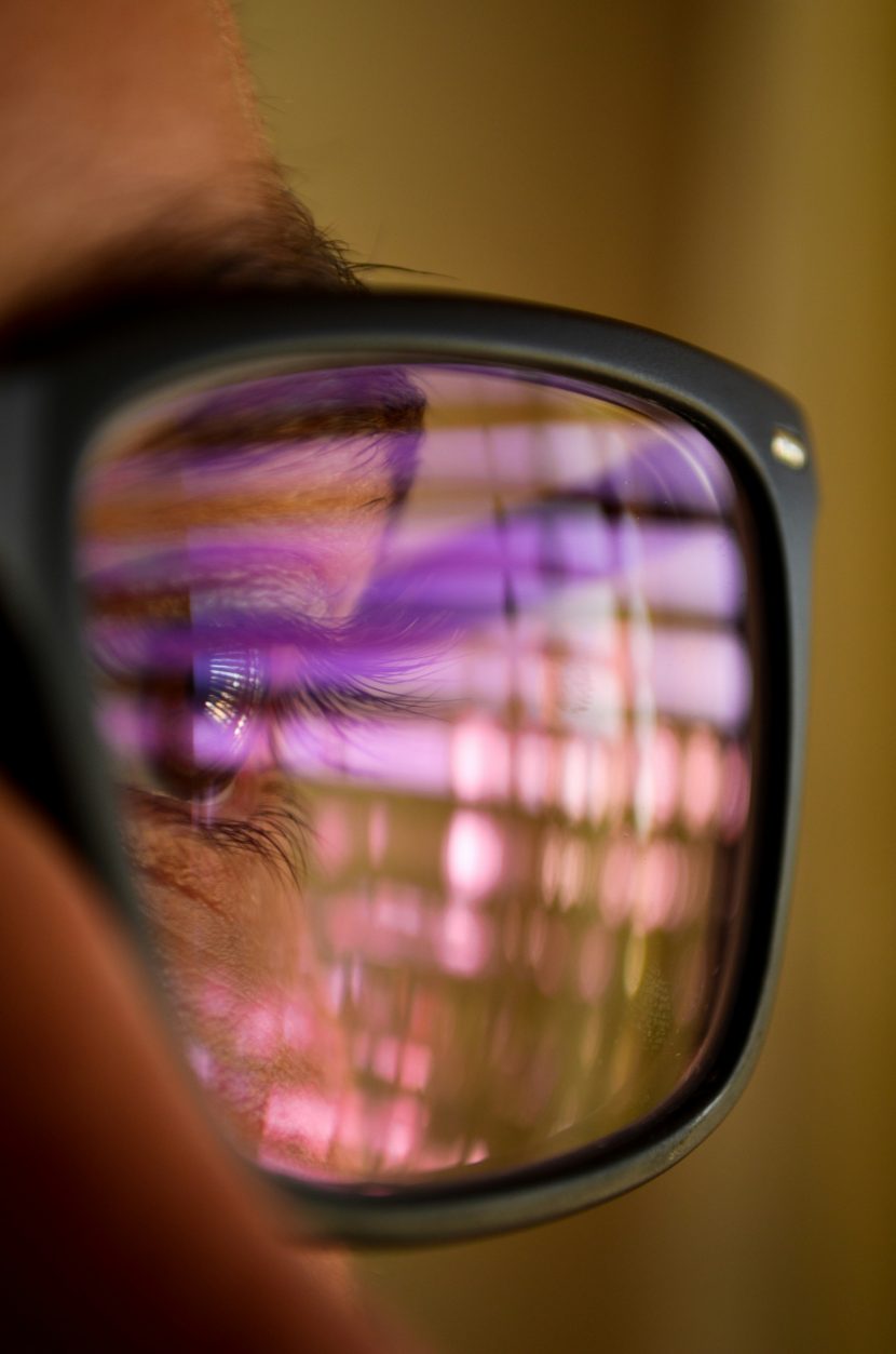 Refractive lens exchange